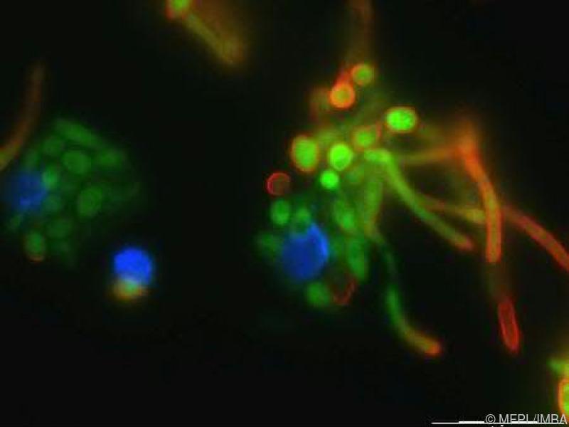 Forscher identifizieren Immunbremse gegen Pilzinfektionen