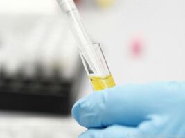 Typ-1-Diabetes lässt sich noch vor den ersten Symptomen diagnostizieren