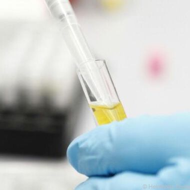 Typ-1-Diabetes lässt sich noch vor den ersten Symptomen diagnostizieren