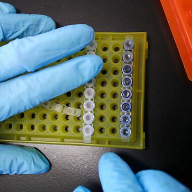 Neue Tumor-Marker auf den Weg gebracht