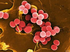 Forscher klären warum Staphylokokken schwere Blutvergiftungen verursachen