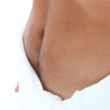 Hernienchirurgie - Bauchwandbruch