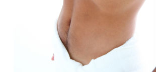 Hernienchirurgie - Bauchwandbruch