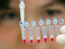 Vergrößerte Thrombozyten weisen auf ein größeres kardiologisches Risiko hin