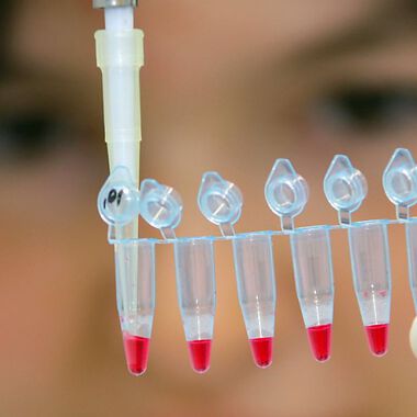 Vergrößerte Thrombozyten weisen auf ein größeres kardiologisches Risiko hin