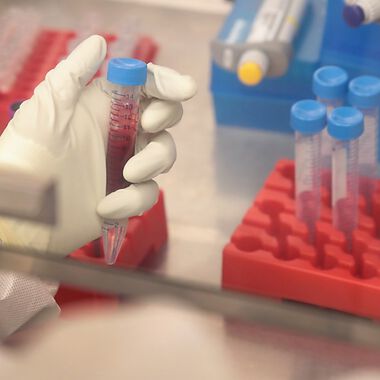 Zika-Virus kann schädlich auch für das Gehirn von Erwachsenen sein