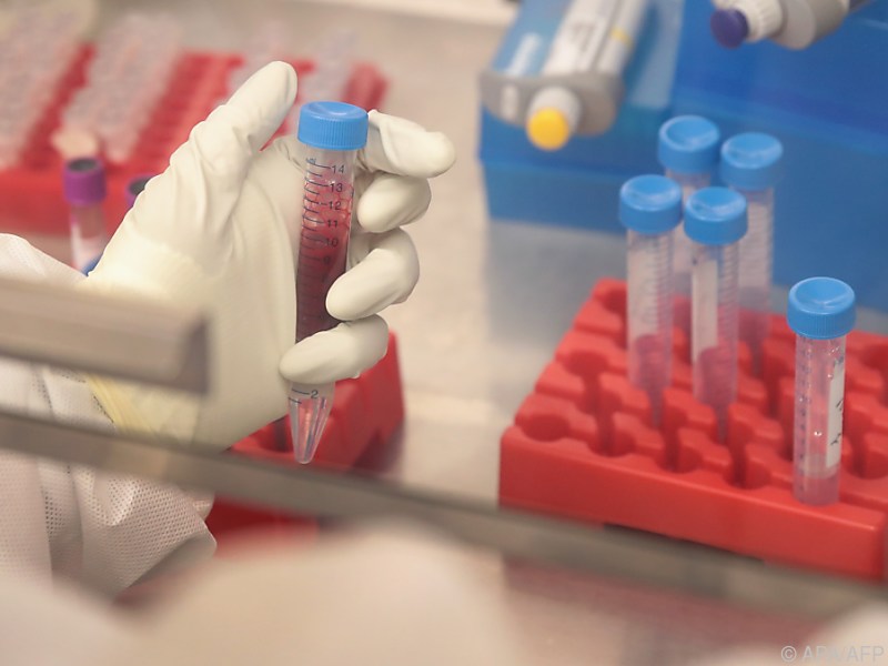 Zika-Virus kann schädlich auch für das Gehirn von Erwachsenen sein