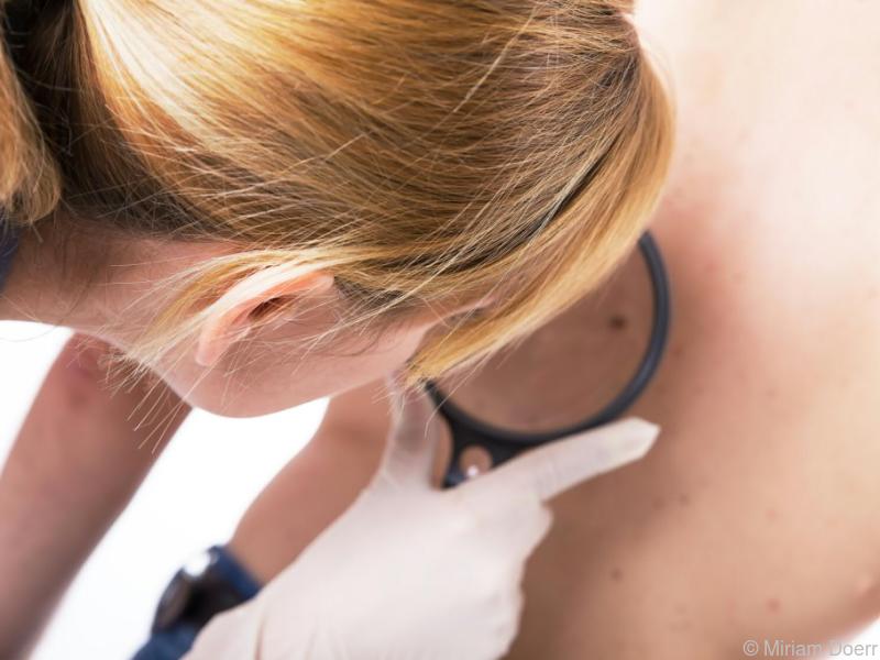 Hautkrebs-Kongress: Auf dem Weg zu neuen Melanom-Therapien bei BRAF-Mutation