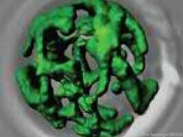 Toxische Kernsphären tragen zur Entstehung von Alzheimer bei