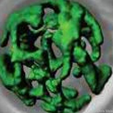 Toxische Kernsphären tragen zur Entstehung von Alzheimer bei