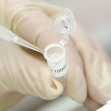Rolle der genetischen Veranlagung beim Verlauf und der Schwere einer Sepsis