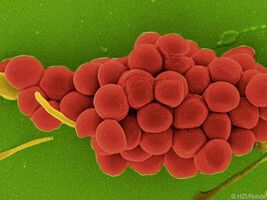 Wie Staphylococcus aureus in der Nase überlebt