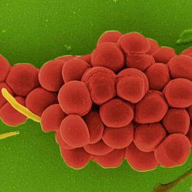 Wie Staphylococcus aureus in der Nase überlebt