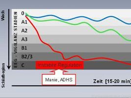 Neue EEG-Methode klärt Ursachen bei Tagesmüdigkeit
