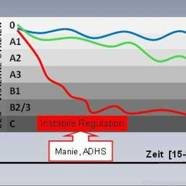 Neue EEG-Methode klärt Ursachen bei Tagesmüdigkeit