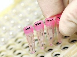 Protein reguliert die Abgabe von Fetten aus der Leber