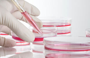 Neue Einblicke in das großzellige anaplastische Lymphom