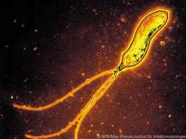 Neue Bindungspartner von Helicobacter pylori gefunden