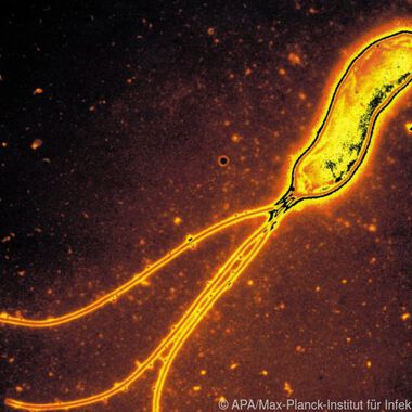 Neue Bindungspartner von Helicobacter pylori gefunden