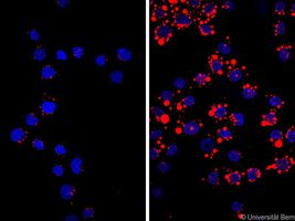 Neues Detail wie Immunzellen zur Arteriosklerose beitragen