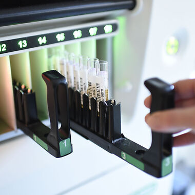 Neue Therapie könnte rasch akute Hepatitis C ausheilen