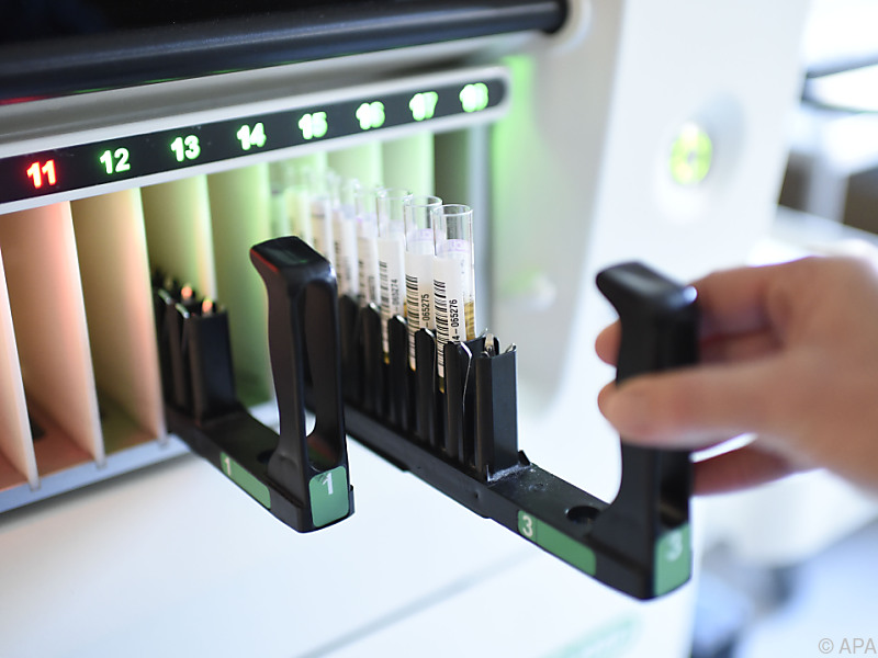 Neue Therapie könnte rasch akute Hepatitis C ausheilen