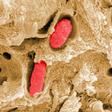 Naturstoffe wirken gegen Salmonellen