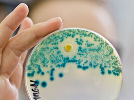 Europäischer Antibiotikatag: Wachsende Zahl an Resistenzen