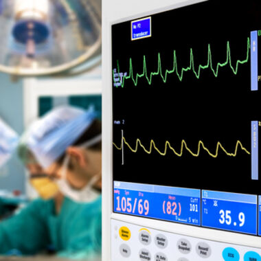 Forscher wollen Aneurysma-Risiko besser abschätzen