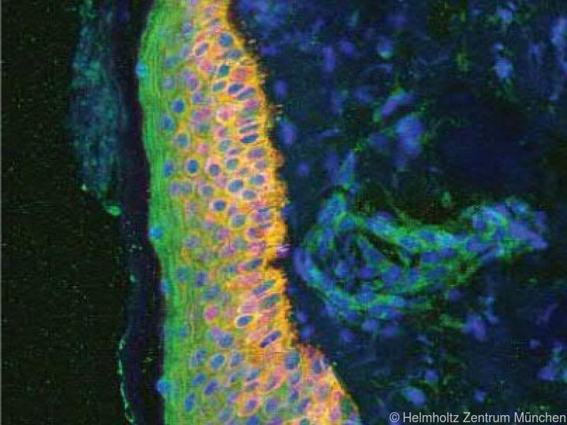 Antikörper hemmt auch "guten" Botenstoff bei Psoriasis
