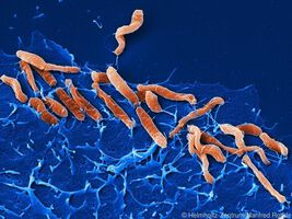 Helicobacter pylori wird schnell zum dominanten Keim