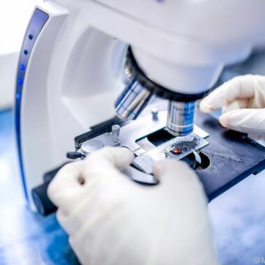 Neuer Therapieansatz für die systemische Mastozytose entdeckt