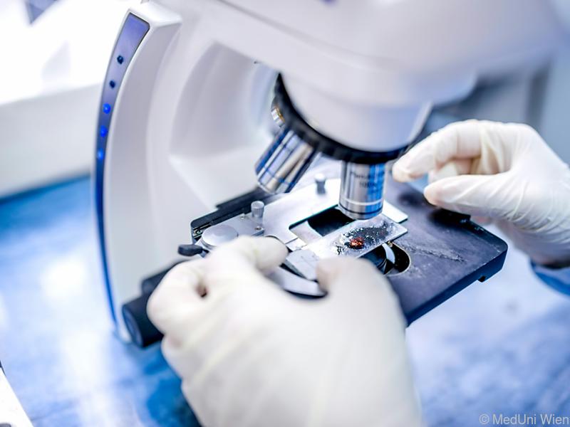 Neuer Therapieansatz für die systemische Mastozytose entdeckt