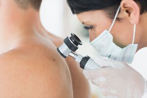 Frühdiagnostik und Therapie beim hellen Hautkrebs