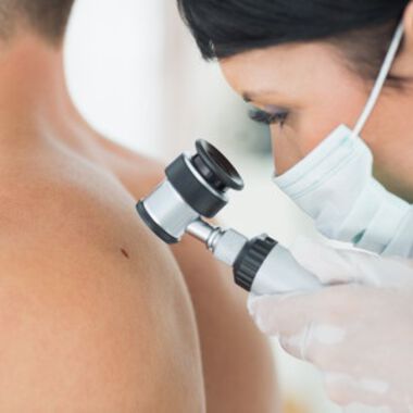 Frühdiagnostik und Therapie beim hellen Hautkrebs