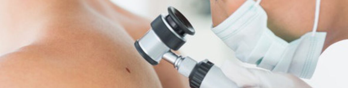Frühdiagnostik und Therapie beim hellen Hautkrebs