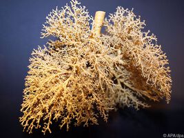 Gene zeigen COPD-Risiko an