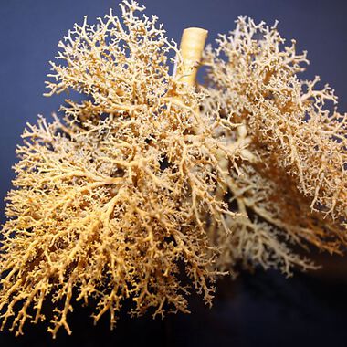 Gene zeigen COPD-Risiko an