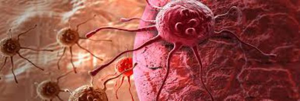 Krebstherapie: kombinierte Methoden steigern Heilungschancen
