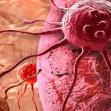 Krebstherapie: kombinierte Methoden steigern Heilungschancen