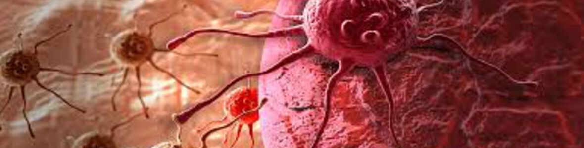 Krebstherapie: kombinierte Methoden steigern Heilungschancen