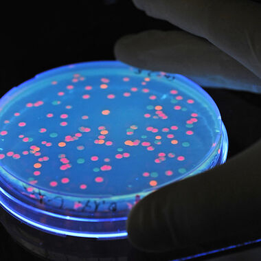 Wie Salmonella das Immunsystem umgeht