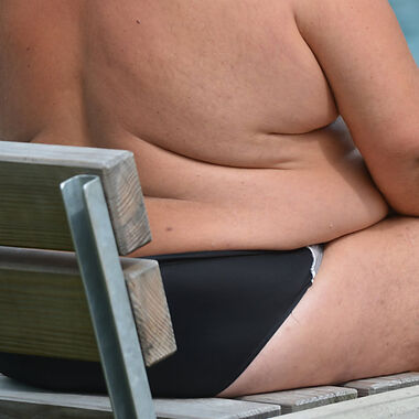 Viele Menschen schätzen ihr Diabetes-Risiko falsch ein