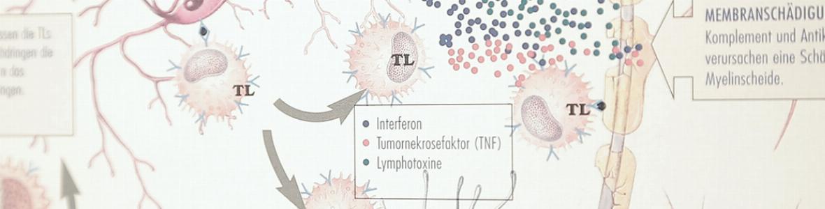 Symptome und Therapiemöglichkeiten von Multiple Sklerose - Video