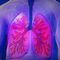 Bronchitis