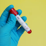 Имунотерапия при инфекция с Epstein-Barr virus започваща като неясно фебрилно състояние
