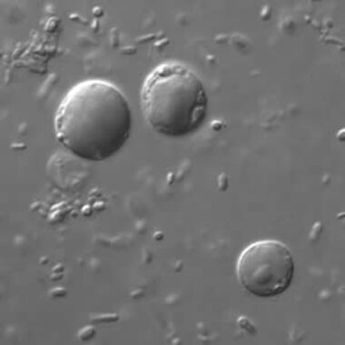 ПРОТОЗОЙНА ЧРЕВНА ФЛОРА ПРИ ДЕЦА С Campylobacter-ИНФЕКЦИЯ