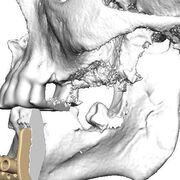 Какво представлява 3D принтирането?