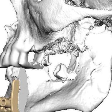 Какво представлява 3D принтирането?