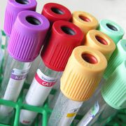 Доброто настроение подобрява действието на ваксините при възрастните хора